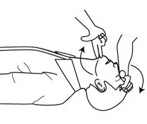 右手で傷病者の男性の顎先に人差し指と中指を当て左手で額を抑えて気道確保をおこなっているバイスタンダーの手元のみを描いたモノクロイラスト